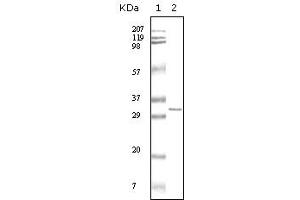 Western blot analysis using HPTR mouse mAb against truncated HPRT recombinant protein. (HPRT1 antibody)