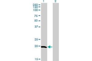 Western Blot analysis of CETN1 expression in transfected 293T cell line by CETN1 monoclonal antibody (M05), clone 4C12. (Centrin 1 antibody  (AA 16-94))