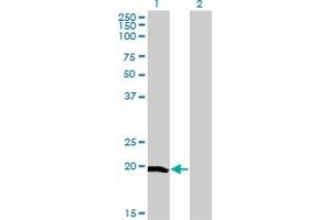 Western Blot analysis of CETN1 expression in transfected 293T cell line by CETN1 monoclonal antibody (M05), clone 4C12.