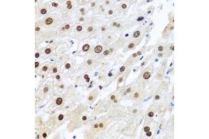 Immunohistochemistry of paraffin-embedded human liver using METTL3 antibody at dilution of 1:100 (40x lens).
