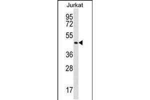 Western blot analysis in Jurkat cell line lysates (35ug/lane). (MAPK14 antibody  (AA 158-192))