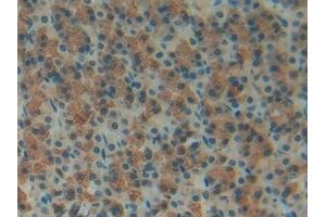 Detection of FOSL1 in Rat Stomach Tissue using Polyclonal Antibody to FOS Like Antigen 1 (FOSL1) (FOSL1 antibody  (AA 1-275))