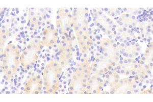 Detection of PCDHb2 in Mouse Kidney Tissue using Polyclonal Antibody to Protocadherin Beta 2 (PCDHb2) (PCDHb2 antibody  (AA 79-253))