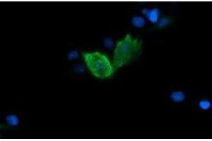 Image no. 3 for anti-Fetal and Adult Testis Expressed 1 (FATE1) antibody (ABIN1498221)