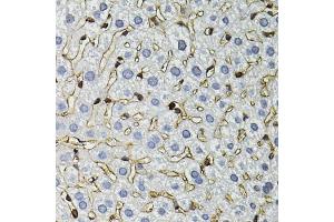 Immunohistochemistry of paraffin-embedded mouse liver using ANXA2 antibody. (Annexin A2 antibody)
