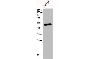 Western Blot analysis of Jurkat cells using DR4 Polyclonal Antibody (TNFRSF1A antibody  (C-Term))