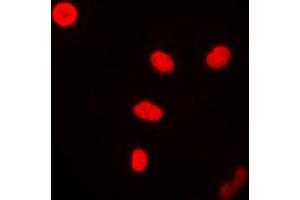 Immunofluorescent analysis of FEN1 staining in MCF7 cells. (FEN1 antibody  (Center))