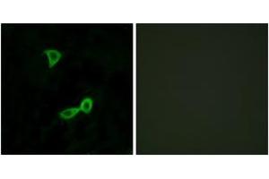 Immunofluorescence analysis of LOVO cells, using GRM2 Antibody. (GRM2 antibody  (AA 241-290))