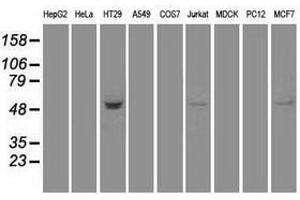 Image no. 2 for anti-serine threonine Kinase 39 (STK39) antibody (ABIN1501212)
