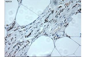 Immunohistochemical staining of paraffin-embedded liver tissue using anti-NEUROG1mouse monoclonal antibody. (Neurogenin 1 antibody)