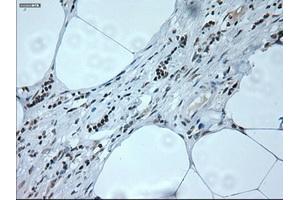 Immunohistochemical staining of paraffin-embedded liver tissue using anti-NEUROG1mouse monoclonal antibody.