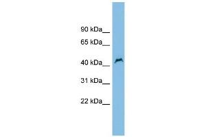 PNPLA1 antibody used at 1 ug/ml to detect target protein. (PNPLA1 antibody  (Middle Region))