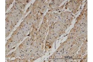 Immunoperoxidase of monoclonal antibody to PANK4 on formalin-fixed paraffin-embedded human heart. (PANK4 antibody  (AA 673-773))