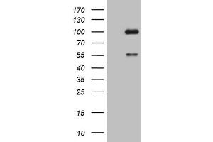 Western Blotting (WB) image for anti-ADAM Metallopeptidase with Thrombospondin Type 1 Motif, 4 (ADAMTS4) (AA 296-577) antibody (ABIN2715720) (ADAMTS4 antibody  (AA 296-577))
