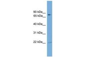 Image no. 1 for anti-Glutamine-Fructose-6-Phosphate Transaminase 2 (GFPT2) (AA 128-177) antibody (ABIN6745488) (GFPT2 antibody  (AA 128-177))