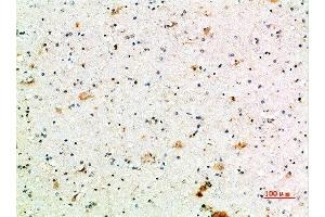 Immunohistochemical analysis of paraffin-embedded human-brain, antibody was diluted at 1:200 (FCGR1A antibody  (AA 230-280))
