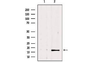 Western blot analysis of extracts from 293, using NME1 Antibody. (NME1 antibody  (C-Term))