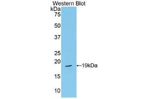 Western blot analysis of the recombinant protein. (Periostin antibody  (AA 659-810))