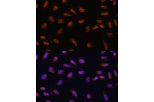 Immunofluorescence analysis of U-2 OS cells using SARNP antibody (ABIN6130106, ABIN6147381, ABIN6147382 and ABIN6217793) at dilution of 1:100. (SARNP antibody  (AA 1-210))