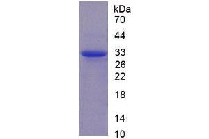 SDS-PAGE analysis of Rat CAPN1 Protein. (CAPNL1 Protein)