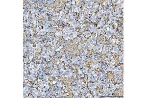 IHC analysis of HLA-DRA using anti-HLA-DRA antibody (ABIN7600948). (HLA-DRA antibody  (AA 26-254))