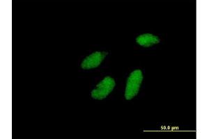 Immunofluorescence of purified MaxPab antibody to RAD1 on HeLa cell. (RAD1 antibody  (AA 1-282))