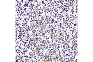 Immunohistochemistry of paraffin-embedded mouse fetal liver using CMIP Rabbit pAb (ABIN7265970) at dilution of 1:50 (40x lens). (CMIP antibody)