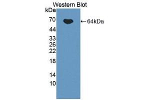 Western blot analysis of the recombinant protein. (IL12B antibody  (AA 23-324))