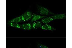 Confocal immunofluorescence analysis of NIH-3T3 cells using ACSS2 Polyclonal Antibody at dilution of 1:200. (ACSS2 antibody)