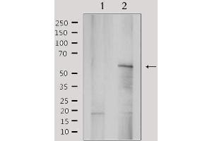 Western blot analysis of extracts from rat brain, using YTHDF1 Antibody. (YTHDF1 antibody  (N-Term))