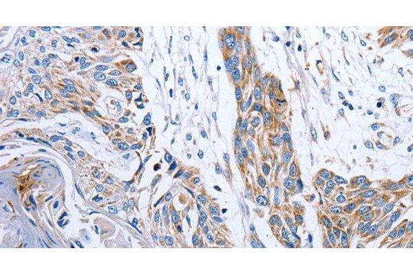 NDUFA12 antibody