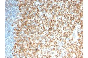 Formalin-fixed, paraffin-embedded human Tonsil stained with MCM7 Recombinant Mouse Monoclonal Antibody (rMCM7/1468).