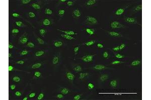 Immunofluorescence of monoclonal antibody to PIK3CB on HeLa cell. (PIK3CB antibody  (AA 147-256))