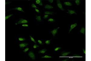 Immunofluorescence of monoclonal antibody to PRKRIP1 on HeLa cell. (PRKRIP1 antibody  (AA 1-184))