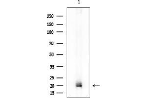 anti-N(alpha)-Acetyltransferase 40 (NAA40) antibody
