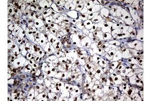 Image no. 1 for anti-Nibrin (NBN) (AA 461-754) antibody (ABIN1491539) (Nibrin antibody  (AA 461-754))