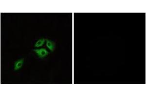 Immunofluorescence analysis of A549 cells, using NMBR Antibody. (NMBR antibody  (AA 221-270))