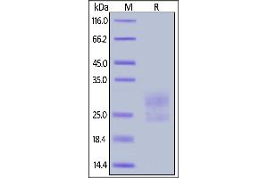 Mouse ICOS (C137S, C138S), His Tag on  under reducing (R) condition. (ICOS Protein (AA 21-144) (His tag))