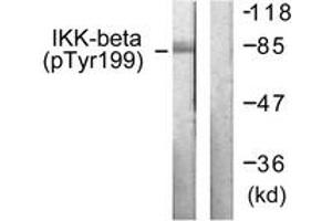 Western blot analysis of extracts from HeLa cells treated with TNF-a 20ng/ml+Calyculin A 50nM 5', using IKK-beta (Phospho-Tyr199) Antibody. (IKBKB antibody  (pTyr199))