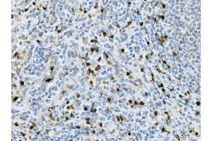 IHC analysis of CXCR2 using anti-CXCR2 antibody (ABIN7603138).