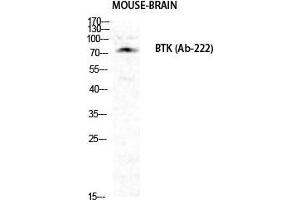 Western Blot (WB) analysis of specific cells using Btk Polyclonal Antibody. (BTK antibody  (Ser189))