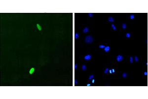 Immunocytochemistry/Immunofluorescence analysis using Mouse Anti-DUX4 Monoclonal Antibody, Clone P2B1 . (DUX4 antibody  (C-Term) (FITC))