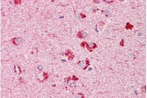 ABIN185304 (3. (RIF1 antibody  (AA 2076-2089))