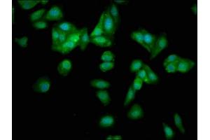 Immunofluorescence staining of HepG2 cells with ABIN7164940 at 1:133, counter-stained with DAPI. (POMP antibody  (AA 1-141))
