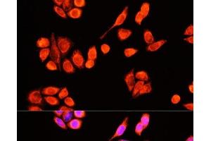 Immunofluorescence analysis of Hela cells using DNAJC19 Polyclonal Antibody at dilution of 1:100 (40x lens). (DNAJC19 antibody)