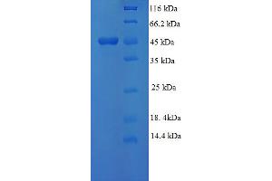 SDS-PAGE (SDS) image for Mitogen-Activated Protein Kinase 3 (MK03) (AA 11-379), (partial) protein (His tag) (ABIN5709905) (MK03 Protein (AA 11-379, partial) (His tag))
