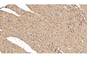 Detection of VEGFA in Rat Cardiac Muscle Tissue using Polyclonal Antibody to Vascular Endothelial Growth Factor A (VEGFA) (VEGFA antibody  (AA 27-190))
