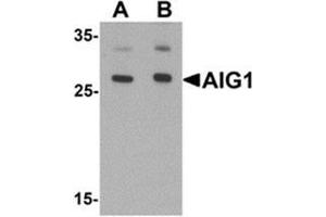 Western blot analysis of AIG1 in human brain tissue lysate with AIG1 antibody at (A) 1 and (B) 2 ug/mL. (AIG1 antibody  (N-Term))