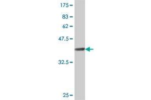 Western Blot detection against Immunogen (37. (GIMAP4 antibody  (AA 125-224))