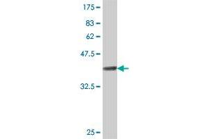 Western Blot detection against Immunogen (37. (GIMAP4 antibody  (AA 125-224))